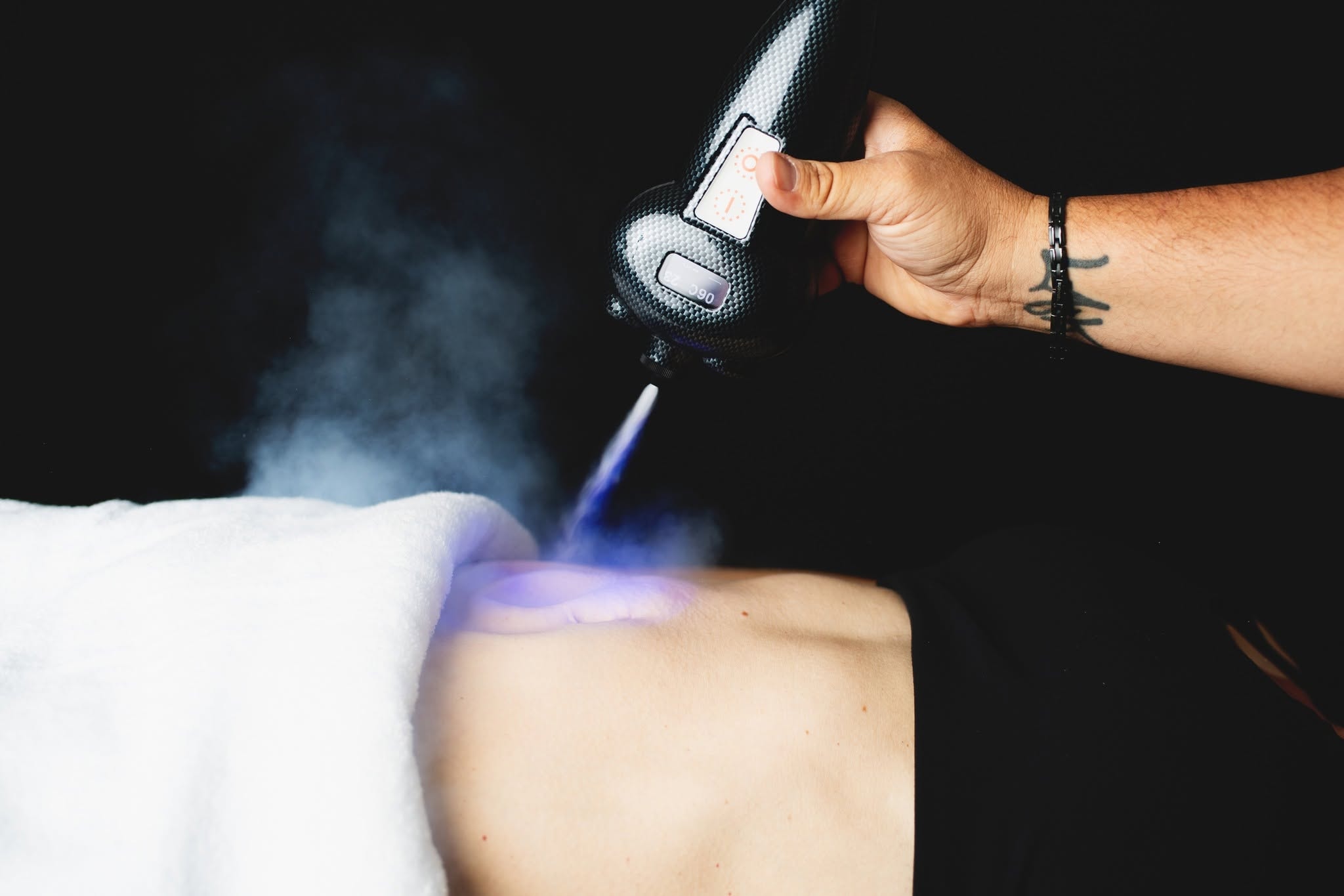 Advanced Cryotherapy Treatment
